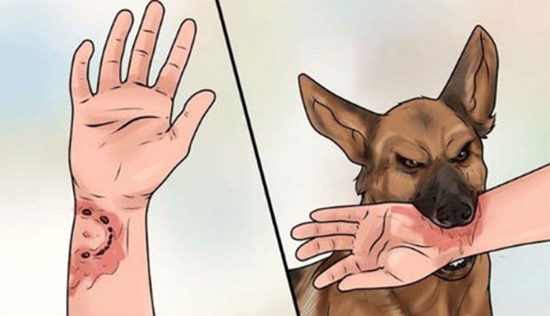 rabies